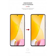 Гидрогелевая пленка ArmorStandart Matte для Xiaomi 12 Lite (ARM62884) Transparent