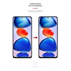 Гидрогелевая пленка ArmorStandart Anti-Blue для Xiaomi Redmi Note 11E Pro Note 11 Pro 5G (ARM63334) Transparent