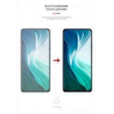 Гидрогелевая пленка ArmorStandart для Xiaomi Mi 11i (ARM59492)